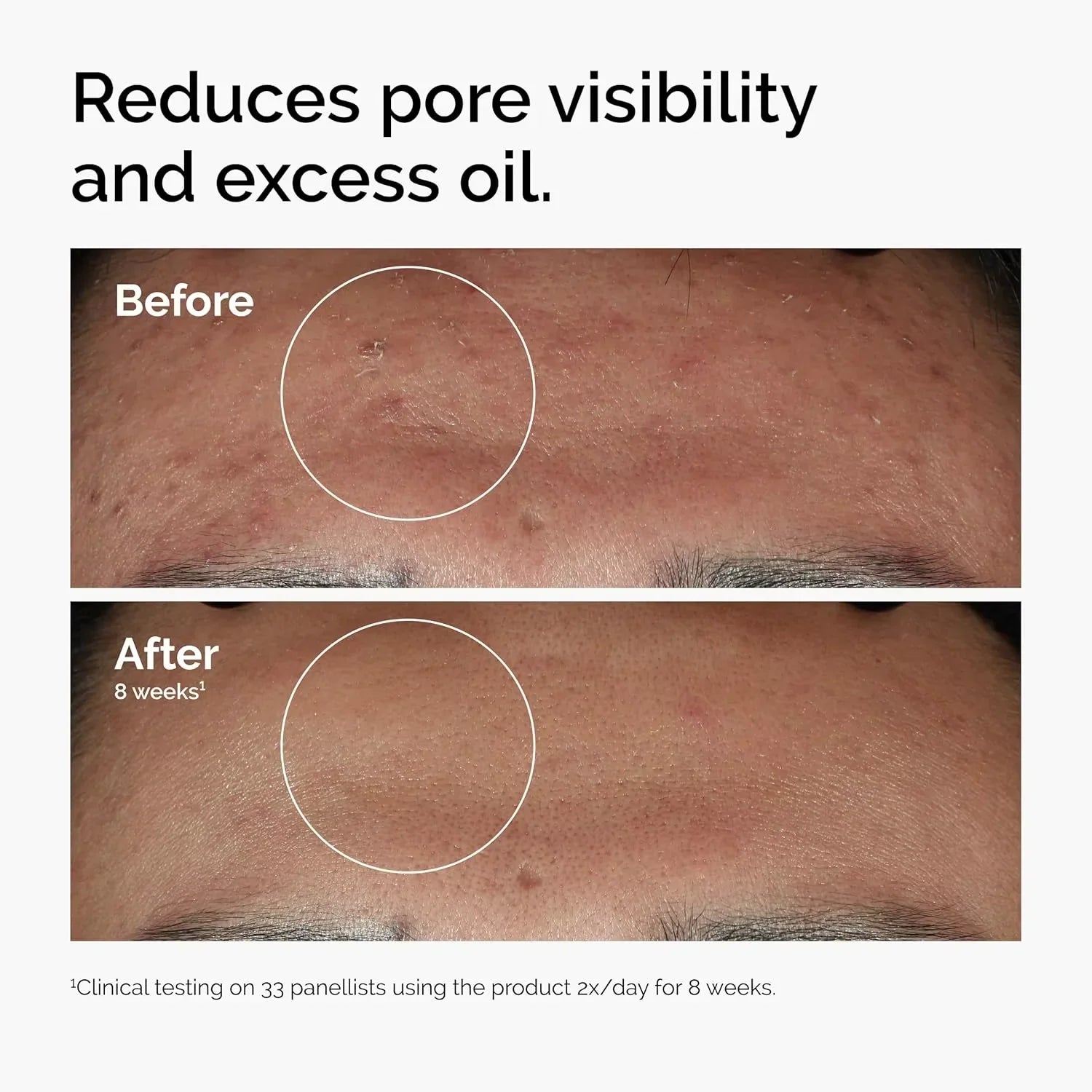 Glow & Clear Skin Serum