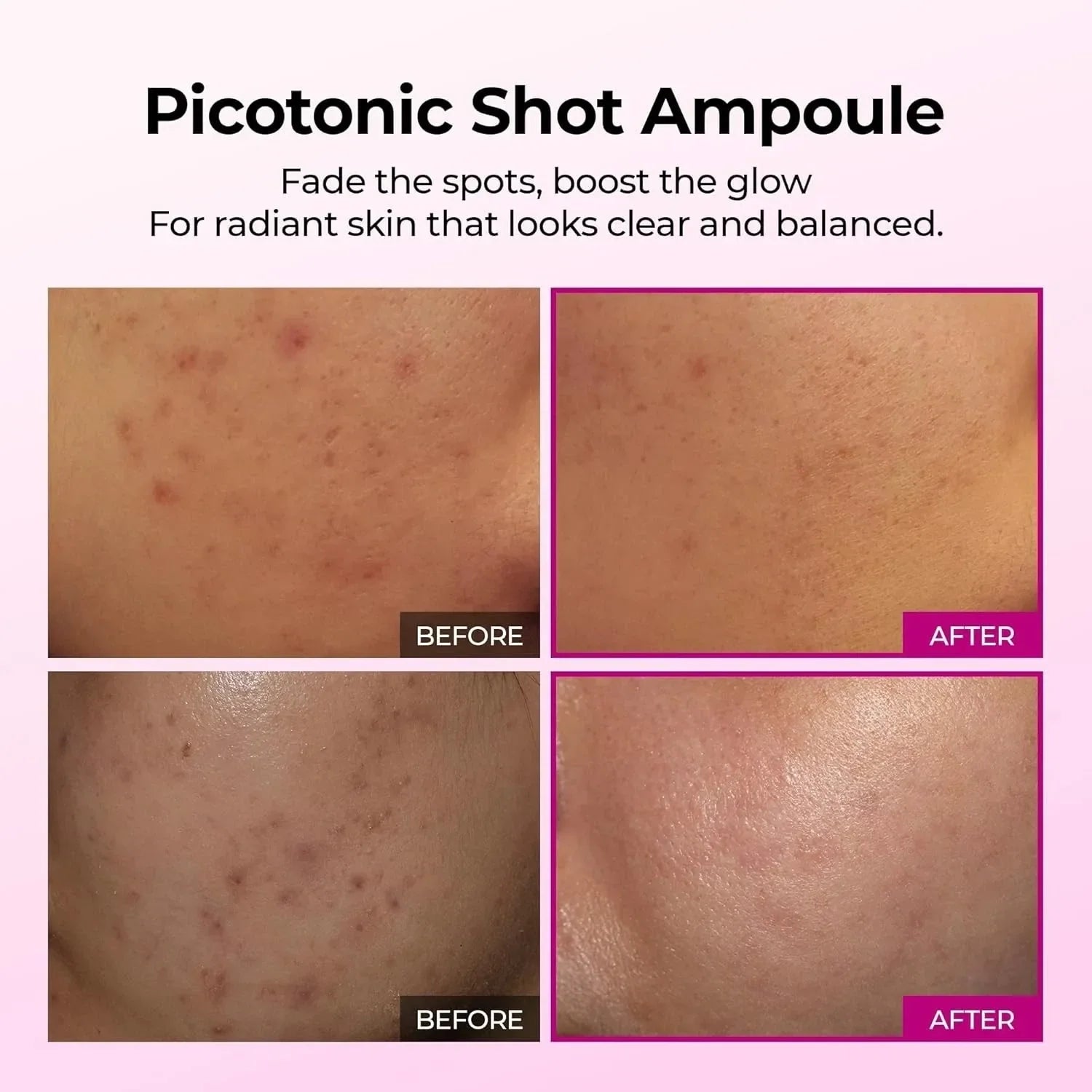 Radiant Glow Shot Serum